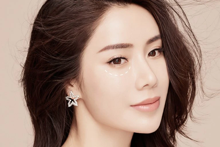 undereye rejuvenation