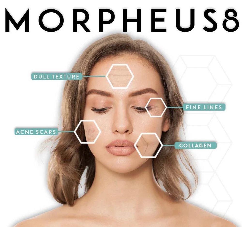 Medical Aesthetics 360 Hurstville 及 Chatswood Morpheus 8 膚質及緊緻療程規劃