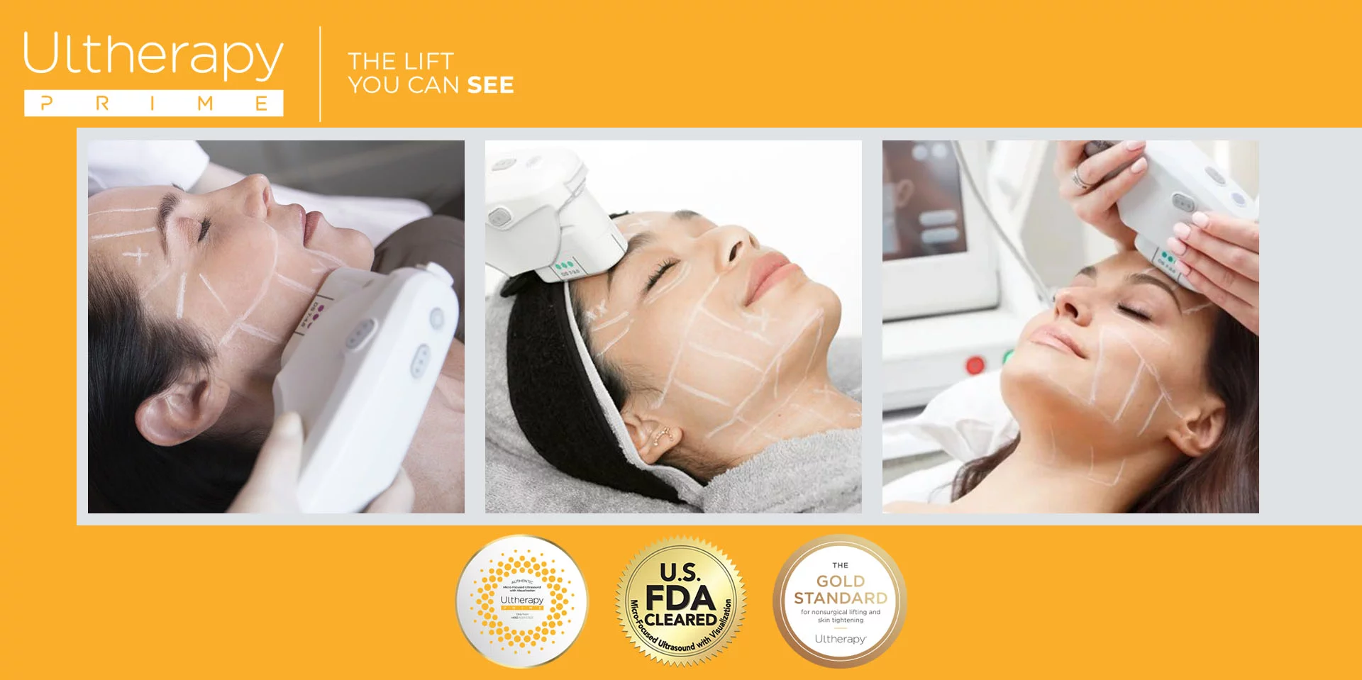 Ultherapy PRIME treatment room at Medical Aesthetics 360 Chatswood and Hurstville