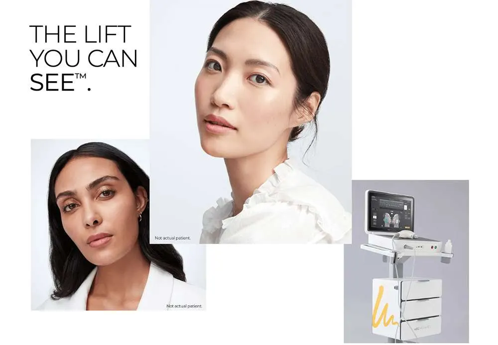 Ultherapy PRIME treatment device and facial treatment areas