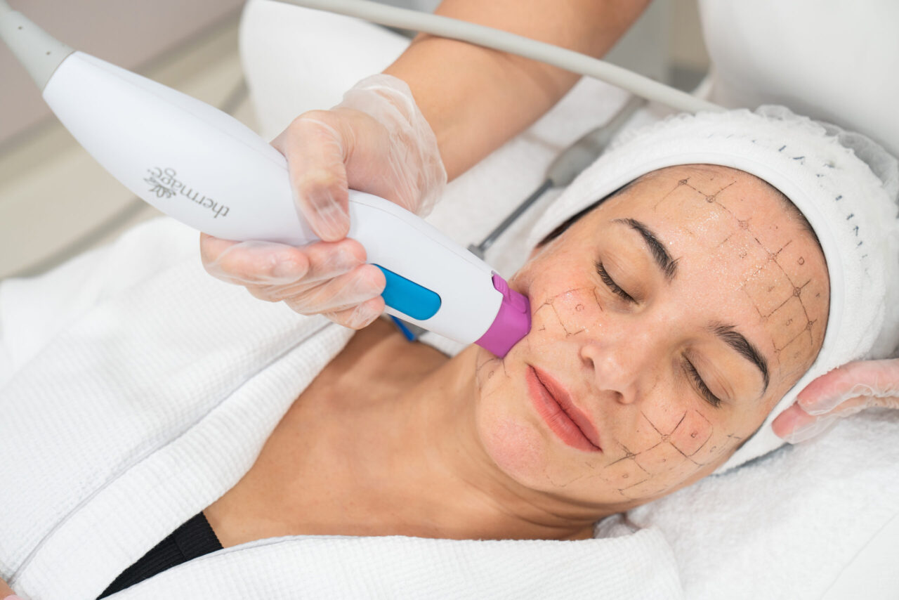 Medical Aesthetics 360 Sydney clinic treatment room for Thermage FLX consultation