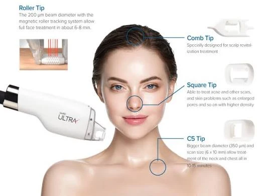 LaseMD handpiece and treatment tips used for different areas
