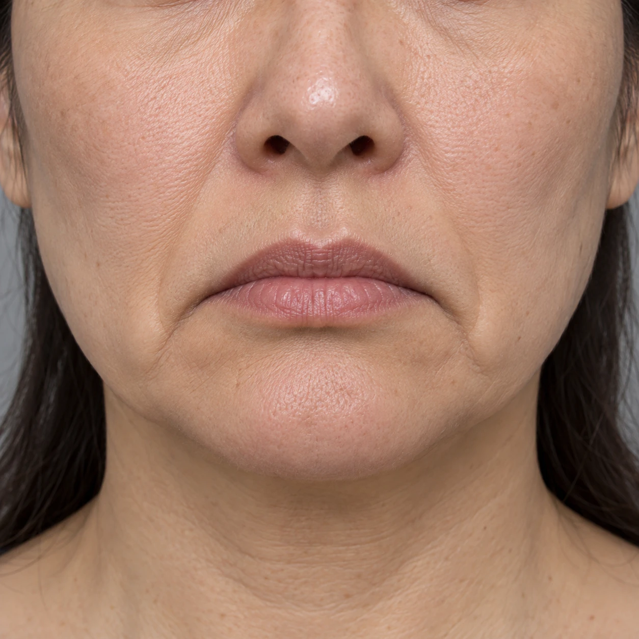 Close-up showing the resting position of downward-facing mouth corners.